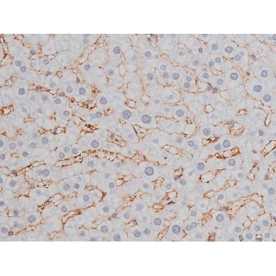 Polyclonal Rabbit anti-Human MAPT / Tau Antibody (phospho-Thr205, IHC, WB)