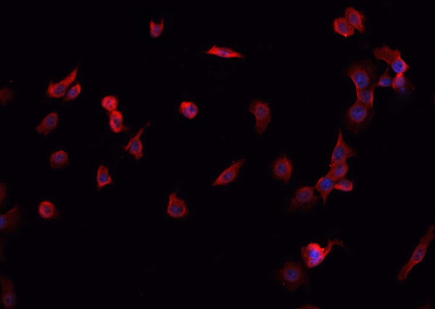 MORF4L1 / MRG15 Antibody