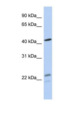 BCKDHA / BCKDE1A Antibody (aa71-120)