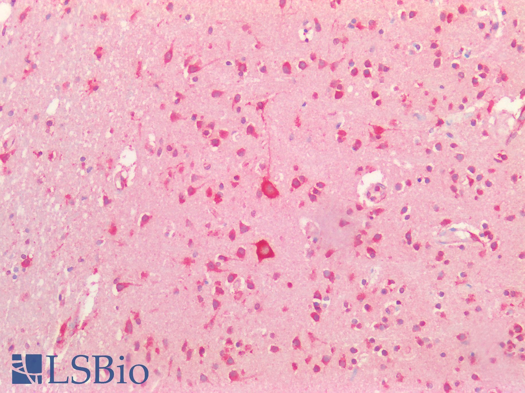 Polyclonal Rabbit anti-Human PMP22 Antibody (IHC, WB)