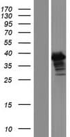 ERCC1 Protein (Over-Expression Lysate Myc-DDK (Flag))