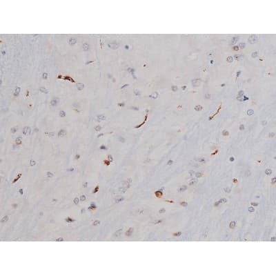 Polyclonal Rabbit anti-Human MAPT / Tau Antibody (phospho-Thr205, IHC, WB)