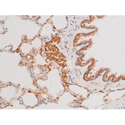 FOXO4 / AFX1 Antibody (phospho-Ser197)