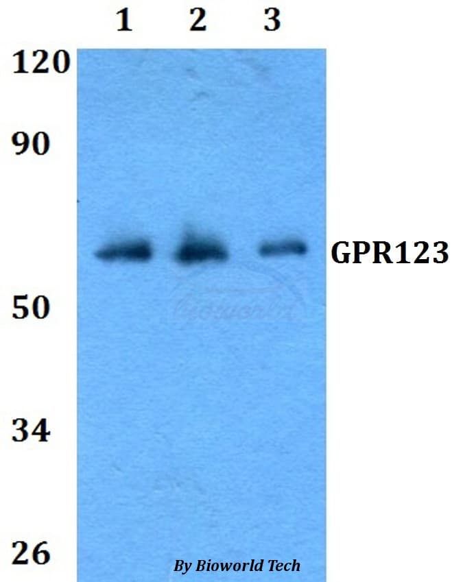 Polyclonal Rabbit anti-Human ADGRA1 / GPR123 Antibody (WB)