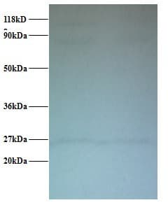 IHC-plus™ CTNNB1 / Beta Catenin Antibody
