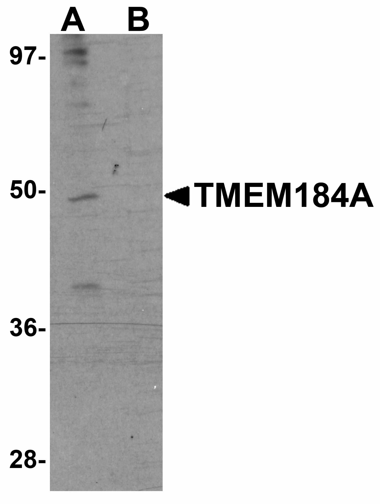 IHC-plus™ TMEM184A Antibody