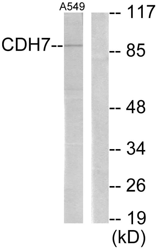 CDH7 / Cadherin 7 Antibody (aa651-700)