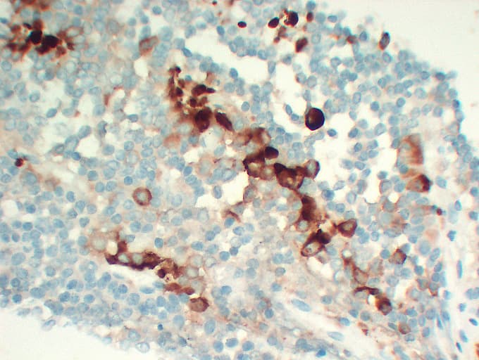 FSHB / FSH Beta Antibody (clone ABT-FSH)