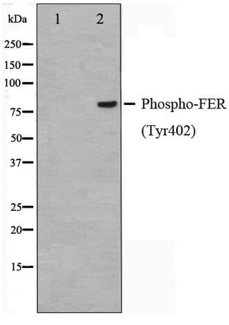 FER Antibody (phospho-Tyr402)