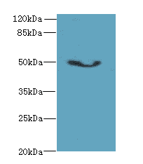 Polyclonal Rabbit anti-Human ADAL Antibody (WB)
