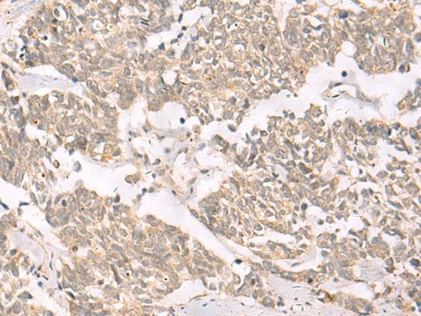 RRP8 Antibody