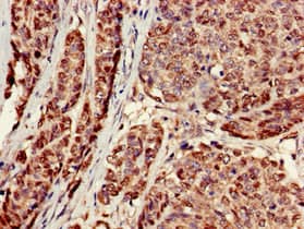 ACTR1A / Centractin Antibody