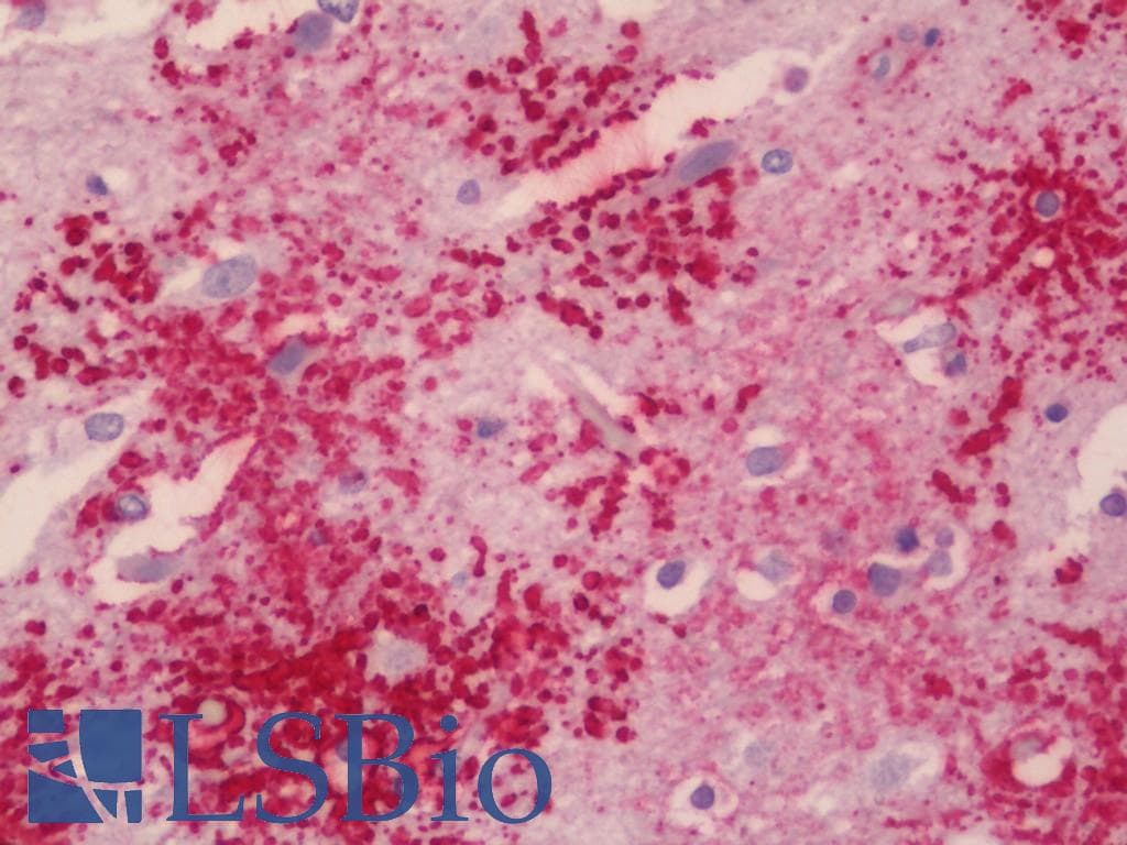 IHC-plus™ KCNMB4 Antibody (aa70-119)