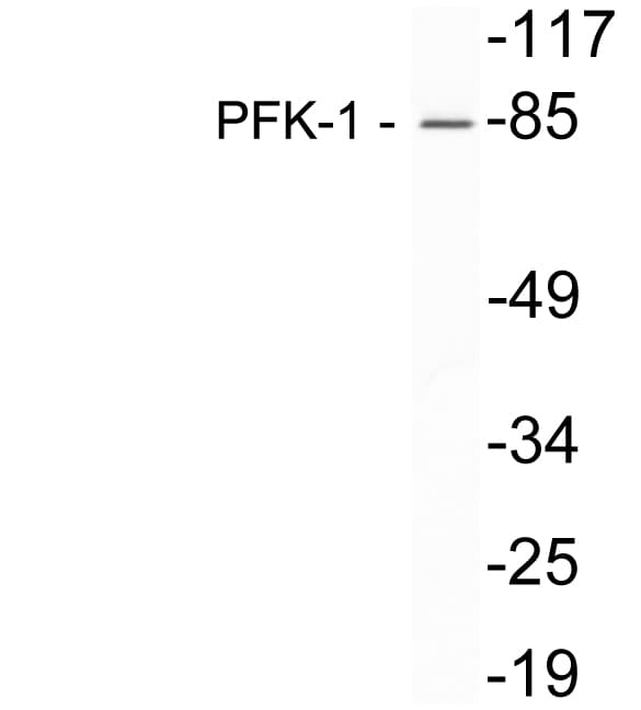 IHC-plus™ PFKM / PFK-1 Antibody (aa320-369)