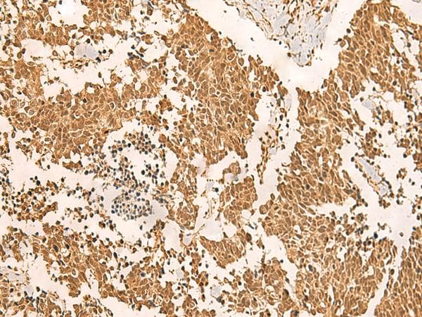 EFTUD2 Antibody