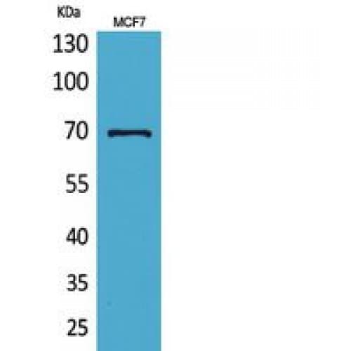 HSP70 / Heat Shock Protein 70 Antibody