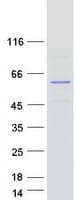 Human SPRYD3 Protein (Recombinant Myc-DDK (Flag))