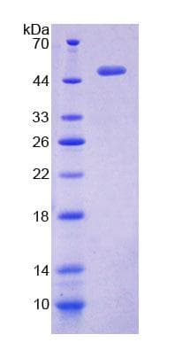 Mouse PPHLN1 Protein (Recombinant His-T7)