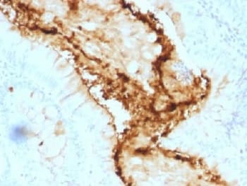 Lewis y / BG8 / CD174 Antibody (clone A70-A/A9)