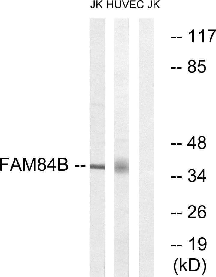 Polyclonal Rabbit anti-Human FAM84B Antibody (aa11-60, WB)