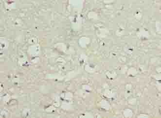 Polyclonal Rabbit anti-Human TMCC1 Antibody (IHC, WB)