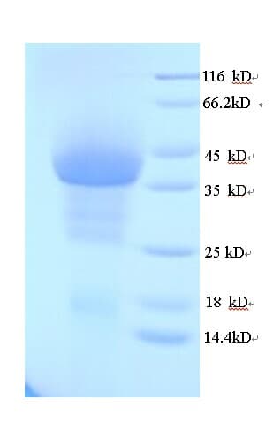 Human Rhinovirus A VP1 Protein (Recombinant His)