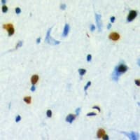 TBL2 Antibody (C-Terminus)