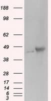 PRKAR2A Antibody (clone OTI1A7, Carrier-free)