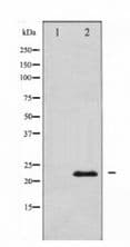 VEGFB Antibody