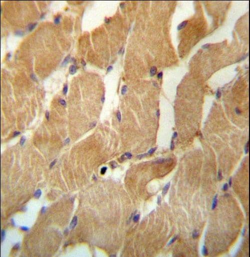 NDUFAF2 / NDUFA12L Antibody (aa71-99)