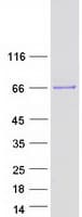 Human KLHL8 Protein (Recombinant Myc-DDK (Flag))