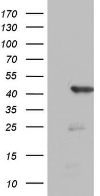 FEN1 Antibody (aa117-380, clone OTI2B2)