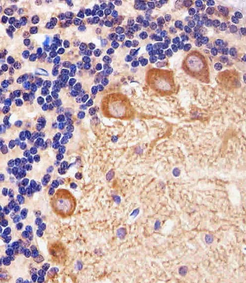 PPT1 / CLN1 Antibody (aa1-306, clone 1117CT11.2.1.4)