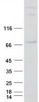 Human RUNX1T1 / ETO Protein (Recombinant Myc-DDK (Flag))