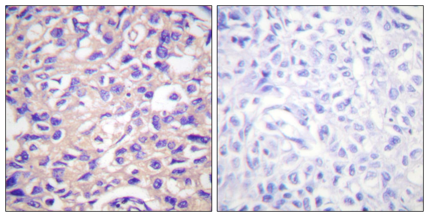 TK1 / TK / Thymidine Kinase Antibody (phospho-Ser13)