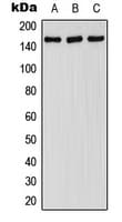 FANCA Antibody (phospho-Ser1149)