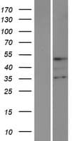 TMPPE Protein (Over-Expression Lysate Myc-DDK (Flag))