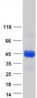 Human C4BPB / C4BP Beta Protein (Recombinant Myc-DDK (Flag))