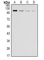 Monoclonal Mouse anti-Human ERN1 / IRE1 Antibody (IHC, WB)