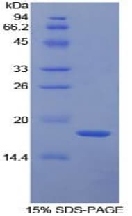 Human TFPI / LACI Protein (Recombinant His)