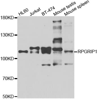 RPGRIP1 Antibody