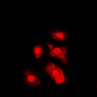 AKT1 + AKT2 + AKT3 Antibody (phospho-Thr308)