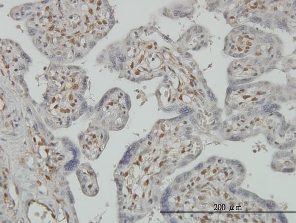 PAPSS2 Antibody (clone 2A8)