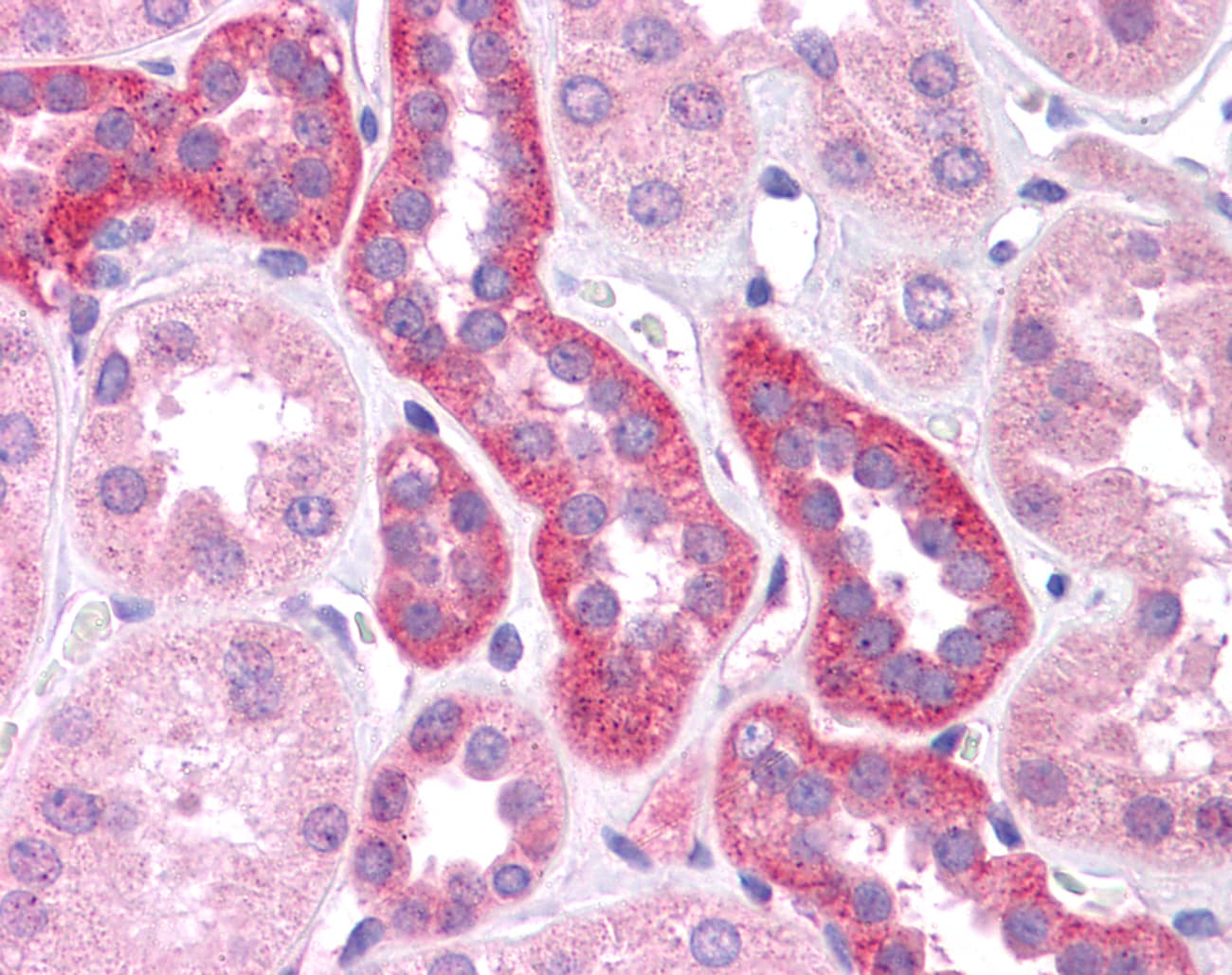 HNF1A / HNF1 Antibody (aa179-228)
