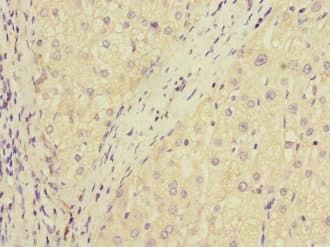 DUSP10 / MKP5 Antibody