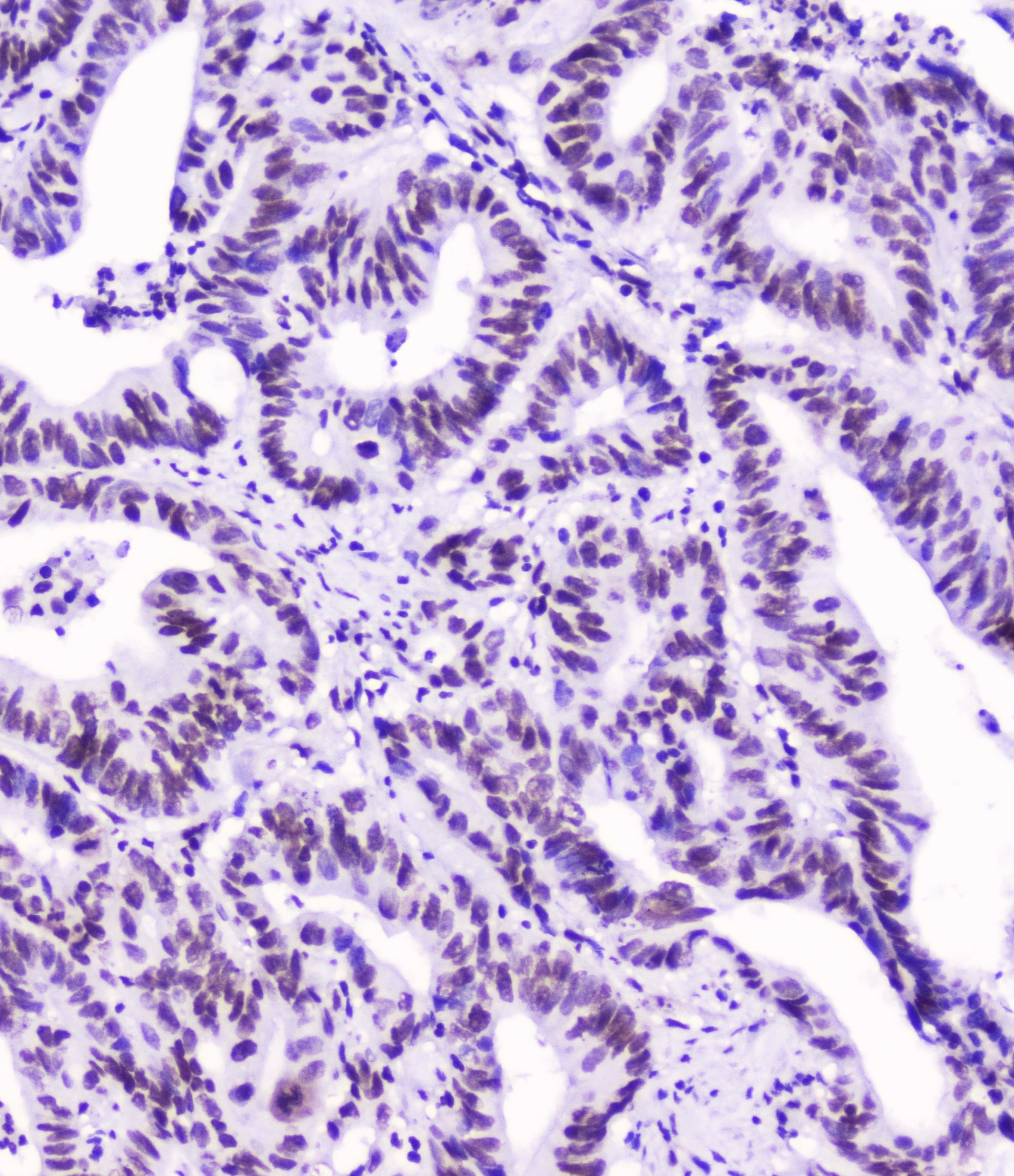 SMC3 / HCAP Antibody