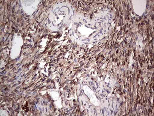Monoclonal Mouse anti-Human LGALS3 / Galectin 3 Antibody (clone OTI15E4, IHC, WB)