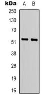LIPI Antibody (Internal)