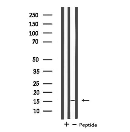 MGST2 Antibody