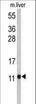 PCBD1 / PHS Antibody (aa11-37)